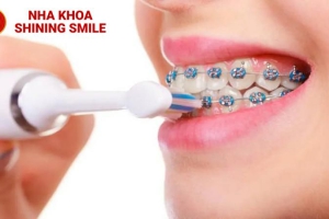 Răng Lấy Tủy Có Nên Bọc Răng Sứ Lại Không? Tư Vấn Từ Chuyên Gia