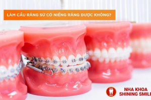 Làm Cầu Răng Sứ Có Niềng Răng Được Không?