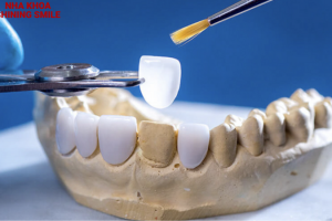 Răng Sứ Zirconia HT: Đặc Điểm Và Ưu Điểm