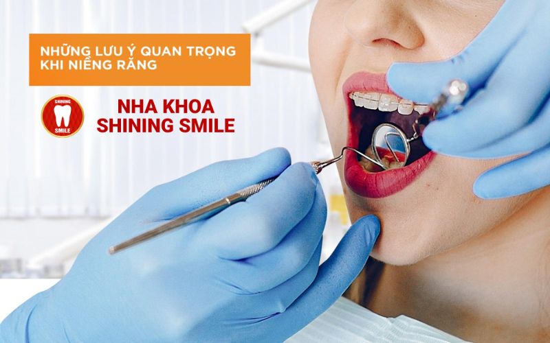 Răng Sứ Crom Cobalt: Giải Pháp Tối Ưu Cho Nụ Cười
