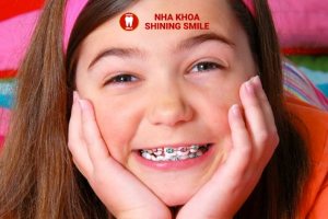 Giải Pháp Khắc Phục và Phòng Ngừa Tình Trạng Niềng Răng Bị Xước Má