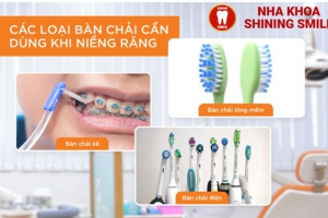 Niềng Răng Trong Suốt Cho Răng Hô: Hiệu Quả Như Thế Nào?