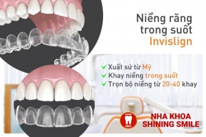 Niềng Răng Có Làm Răng Dài Ra Không? Giải Đáp Chi Tiết
