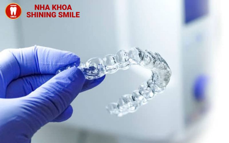 Niềng Răng Có Làm Thay Đổi Khuôn Mặt Không