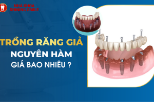 Nhanh chóng - An toàn - Tiết kiệm: Trồng răng giả nguyên hàm giá rẻ tại nha khoa Shining Smile