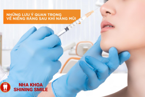 Bọc Răng Sứ Dính Liền: Có Nên Hay Không?
