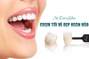Răng Sứ Lava Plus: Tự nhiên - Bền chắc - An toàn