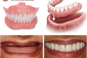 Lựa Chọn Phục Hình: Trồng Răng Tháo Lắp Có Thực Sự Hiệu Quả?