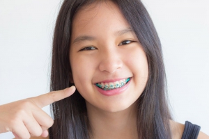 Độ Tuổi Niềng Răng Nào Là Hợp Lý?
