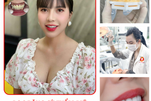 MÀI RĂNG BỌC SỨ CÓ ĐAU KHÔNG? CÓ ẢNH HƯỞNG GÌ KHÔNG?