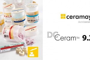 Răng Sứ Ceramay: Mang đến vẻ đẹp tự nhiên cho nụ cười