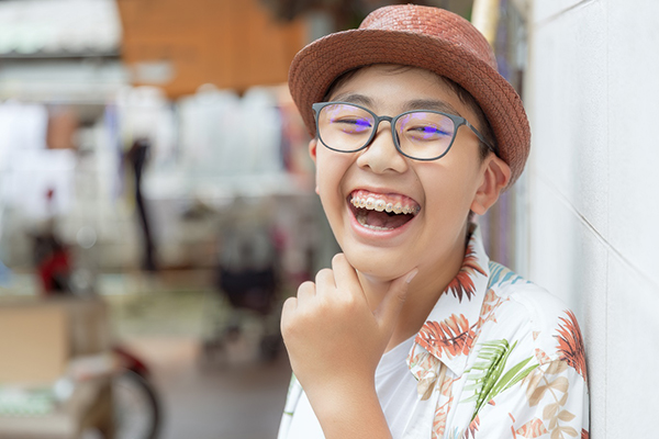 Niềng răng trẻ em - NKLX