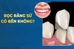 Bọc Răng Sứ Có Bền Không? Đánh Giá Từ Chuyên Gia