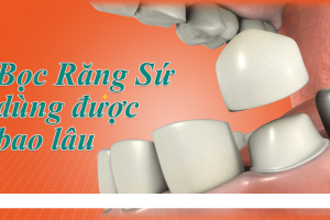 Bọc răng sứ sử dụng được bao lâu?