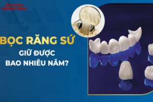 Bọc Răng Sứ Được Bao Lâu? Độ Bền Và Cách Bảo Quản