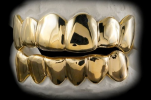 Bọc Răng Vàng Giá Bao Nhiêu? Tìm Hiểu Chi Phí Và Quy Trình