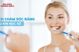 Cách Chăm Sóc Răng Sứ: Bí Quyết Giữ Gìn Nụ Cười Tươi Tắn