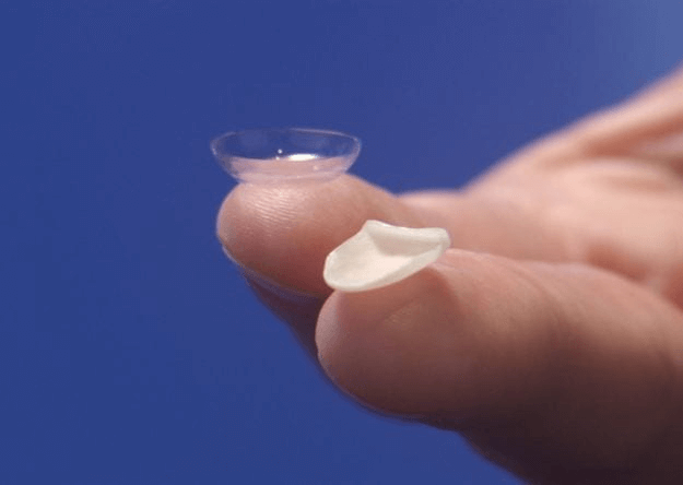 Dán sứ đem lại tính thẩm mỹ cao cho hàm răng