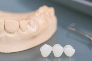 Làm Răng Có Đau Không? Trải Nghiệm Thực Tế