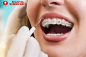 50 tuổi có niềng răng được không