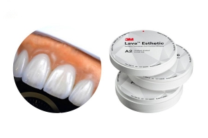 Răng Sứ Lava Esthetic: Nâng tầm nụ cười Việt