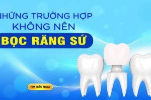 Những Trường Hợp Không Nên Bọc Răng Sứ: Lời Khuyên Từ Chuyên Gia