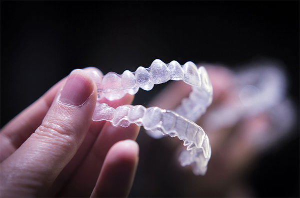 Niềng răng Invisalign