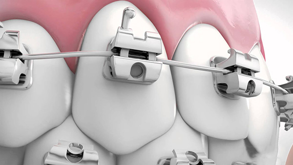 nieng-rang-mac-cai-inox-tu-dong