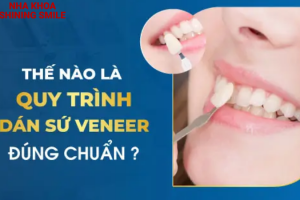 Quy Trình Dán Sứ Veneer: Từng Bước Một Chi Tiết