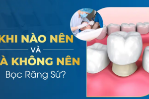 Răng Đã Trám Có Bọc Sứ Được Không? Thông Tin Chi Tiết