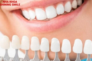 Răng Sứ Ceramic: Ưu Điểm Và Ứng Dụng