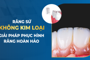Răng Sứ Không Kim Loại: Ưu Điểm Và Nhược Điểm