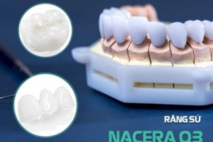 Răng Sứ Nacera Q3: Nụ cười tỏa sáng cùng thời gian