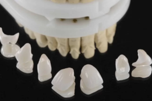 Răng Sứ Sage: Sự Lựa Chọn Hoàn Hảo Cho Nụ Cười Tươi Sáng