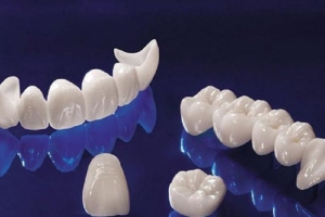 Răng Toàn Sứ: Ưu Điểm Vượt Trội Và Lý Do Nên Chọn