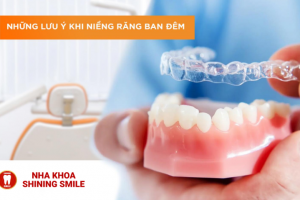 Niềng Răng Ban Đêm: Giải Pháp Tối Ưu Cho Cuộc Sống Bận Rộn