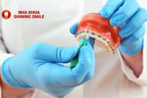 Niềng Răng Có Đi Máy Bay Được Không? Lời Khuyên Quan Trọng