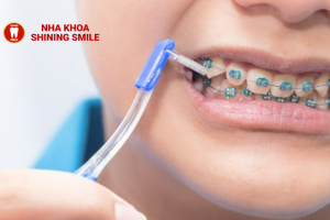 Dụng Cụ Vệ Sinh Răng Niềng: Lựa Chọn Tối Ưu Cho Bạn