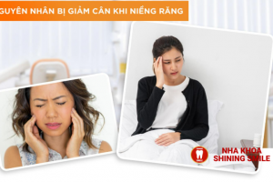 Niềng Răng Có Giúp Giảm Cân? Sự Thật Đằng Sau Mỹ Thuật và Sức Khỏe