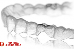 Niềng Răng Trong Suốt Clear Aligner: Lựa Chọn Thẩm Mỹ Hoàn Hảo