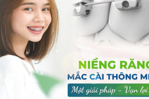 Công Nghệ Mắc Cài Thông Minh: Bước Đột Phá Trong Niềng Răng