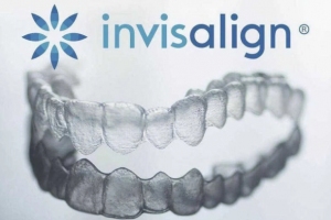 Niềng Răng Trong Suốt Có Cần Nhổ Răng Không?