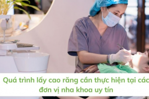 Niềng Răng và Lấy Cao Răng: Liệu Có Thể Kết Hợp?