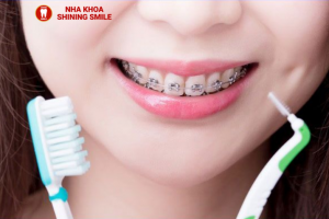 Niềng Răng Gây Ê Buốt Khi Uống Nước: Nguyên Nhân và Cách Khắc Phục