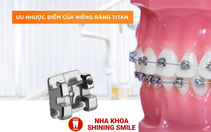 Trồng Răng Bao Nhiêu Tiền? Tìm Hiểu Ngay Chi Phí Mới Nhất!