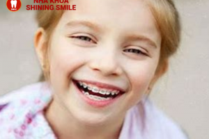 Độ tuổi vàng cho việc niềng răng