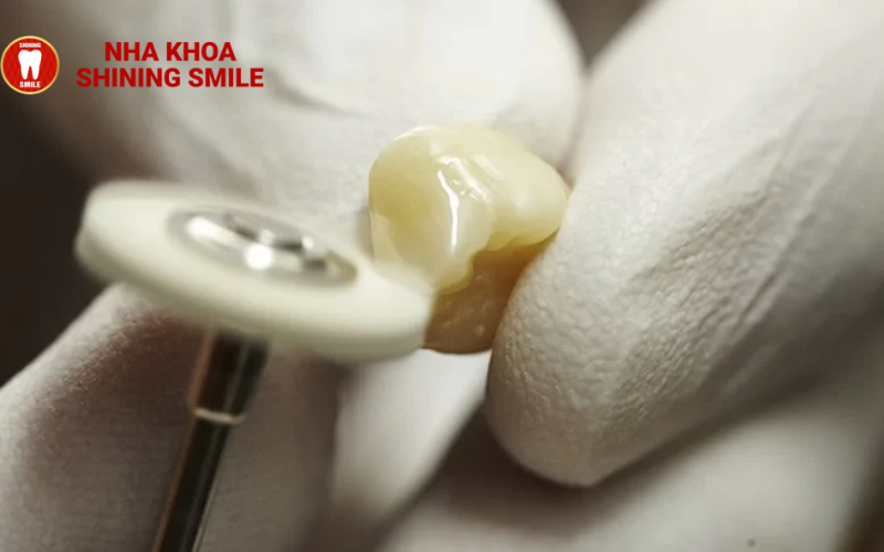 Niềng răng mặt trong là gì? Ưu và nhược điểm của niềng răng mặt trong