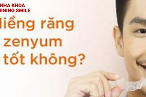 Niềng răng Zenyum: Có tốt như lời đồn?