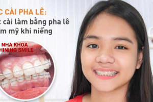Bí Mật Niềng Răng Mắc Cài Pha Lê - Giá Hợp Lý tại SHINING SMILE