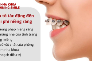 Khám phá bí mật: Niềng răng 14 tuổi - Bạn cần bao nhiêu tiền